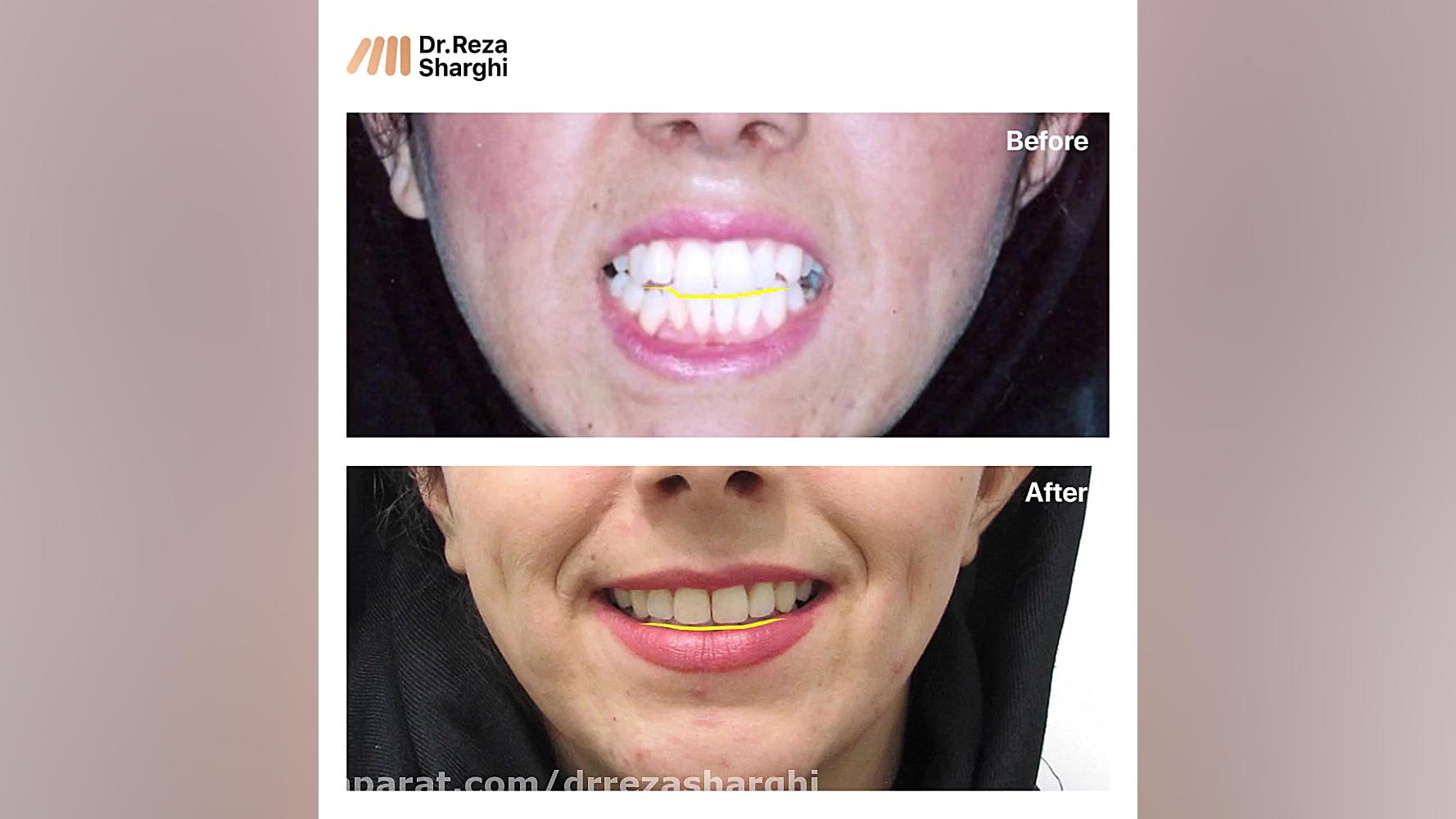 روند درمان ارتودنسی - دکتر رضا شرقی متخصص ارتودنسی در تبریز دکتر رضا شرقی