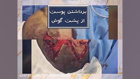 جراحی زیبایی گوش هولوگرام سه‌بعدی جراحی