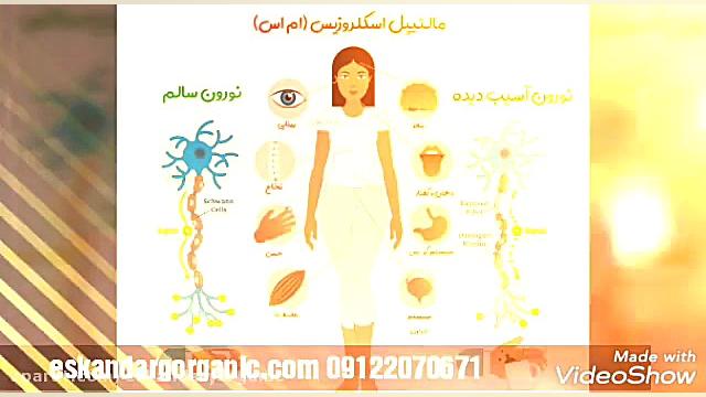 پیشگیری و درمان بیماری ام اس با طب سنتی حگیم اسکندری جراحی فک