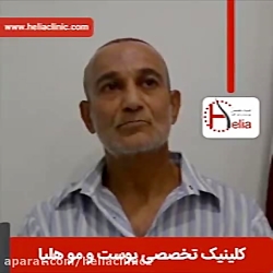 فیلم کاشت مو | کلینیک پوست و مو هلیا | شماره 12 | 02179547