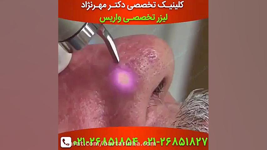 برترین ها - کلینیک پوست، مو، لیزر و لاغری باران 1 CUT&Tag