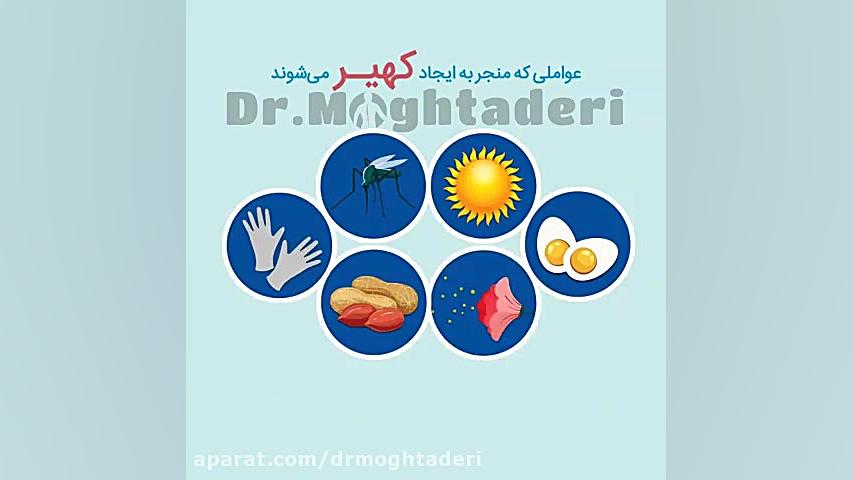 عواملی که منجر به ایجاد کهیر می‌شوند دکتر علیرضا مقتدری | متخصص طب فیزیکی