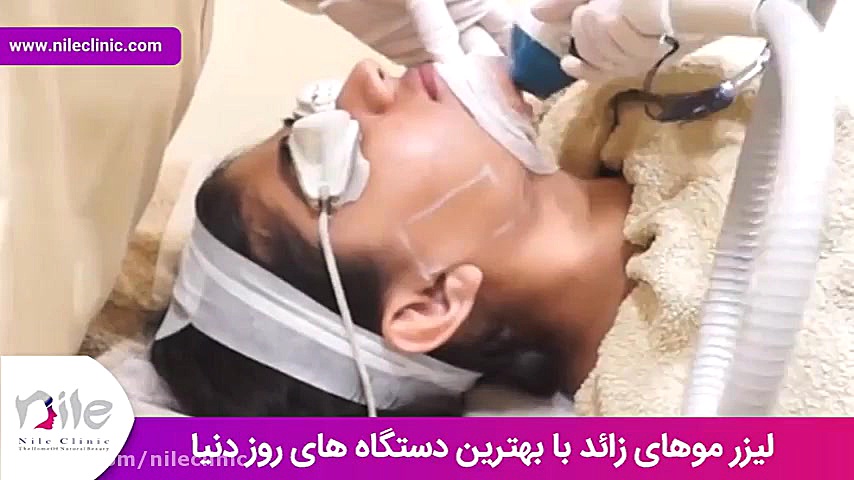 لیزر موهای زائد | فیلم لیزر موهای زائد | کلینیک پوست و مو نیل | شماره 10 هموکروماتوز