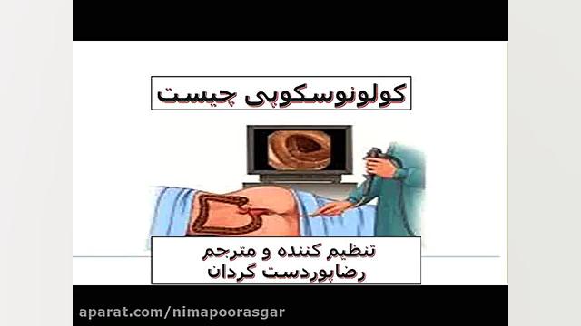 گولونوسکوپی چیست پیلینگ