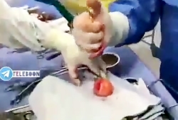 عوارض قرص چاقی و لاغری