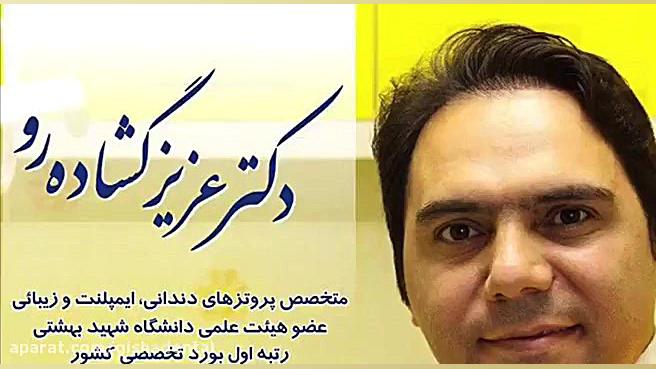بازسازی کامل دندانها با ایمپلنت در فردی با مشکل پریودنتال پیشرفته کلینیک دندانپزشکی دکتر عزیز گشاده رو