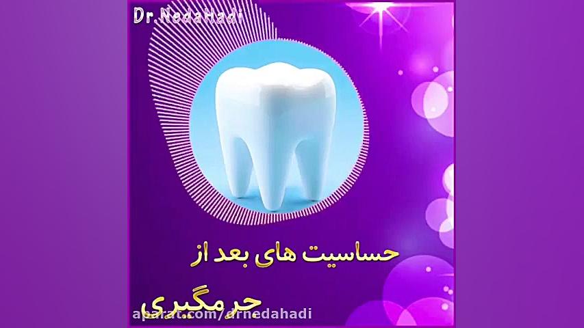 حساسیت های بعد از جرمگیری دندان دکتر ندا هادی-دندانپزشک زیبایی