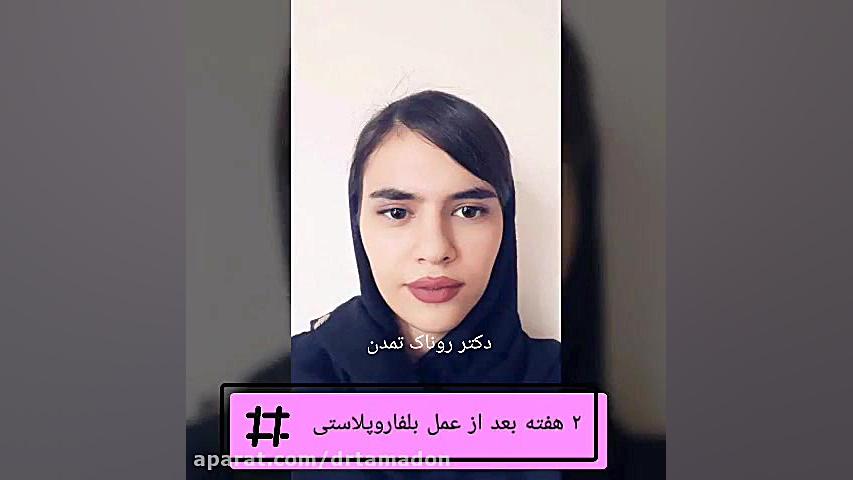 جراحی افتادگی پلک کلینیک پوست