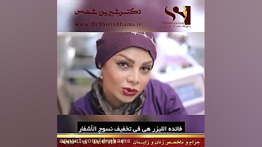 تبییض المهبل دکتر شیرین شمس جراح و متخصص زنان و زایمان