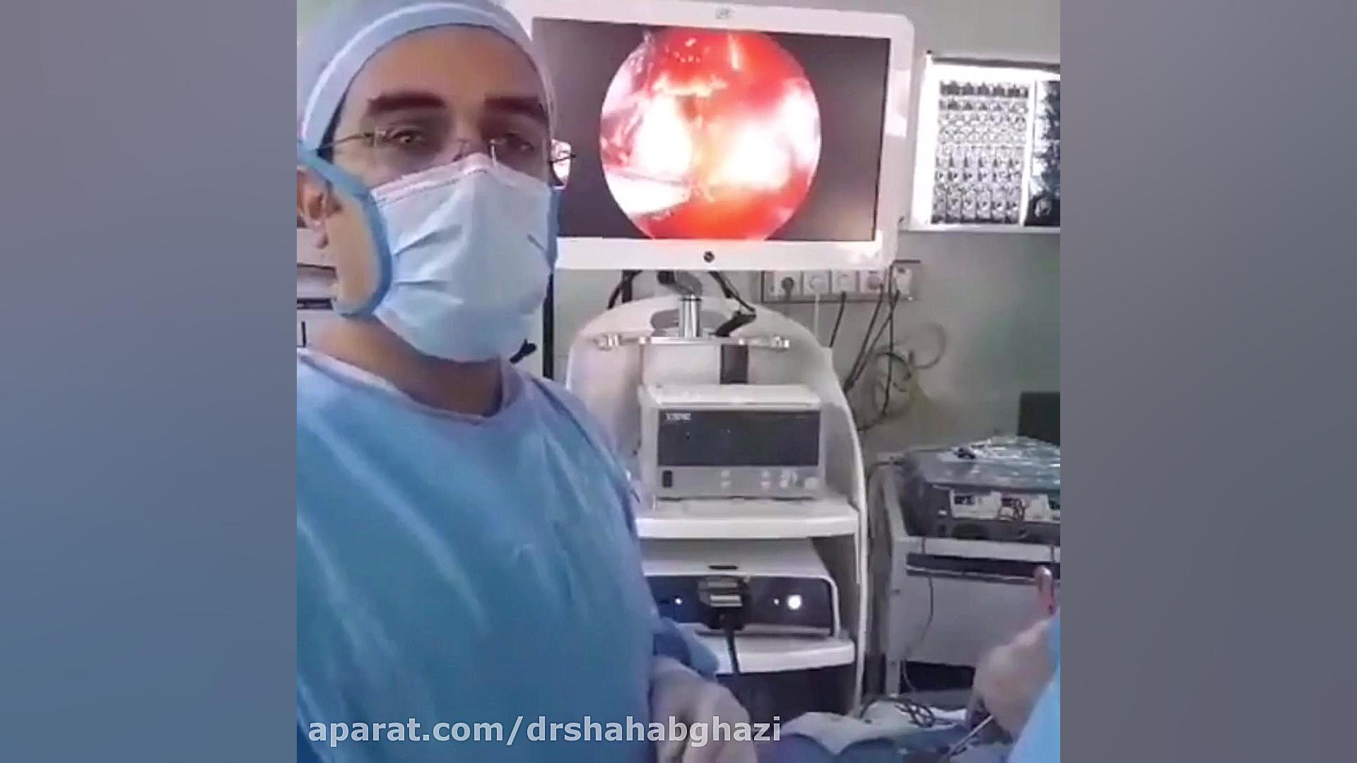 کلیپ پزشکی جراحی تومور هیپوفیز،دکتر میرسعید،پزشک جراح متخصص مغز و اعصاب26712439 کاشت مو