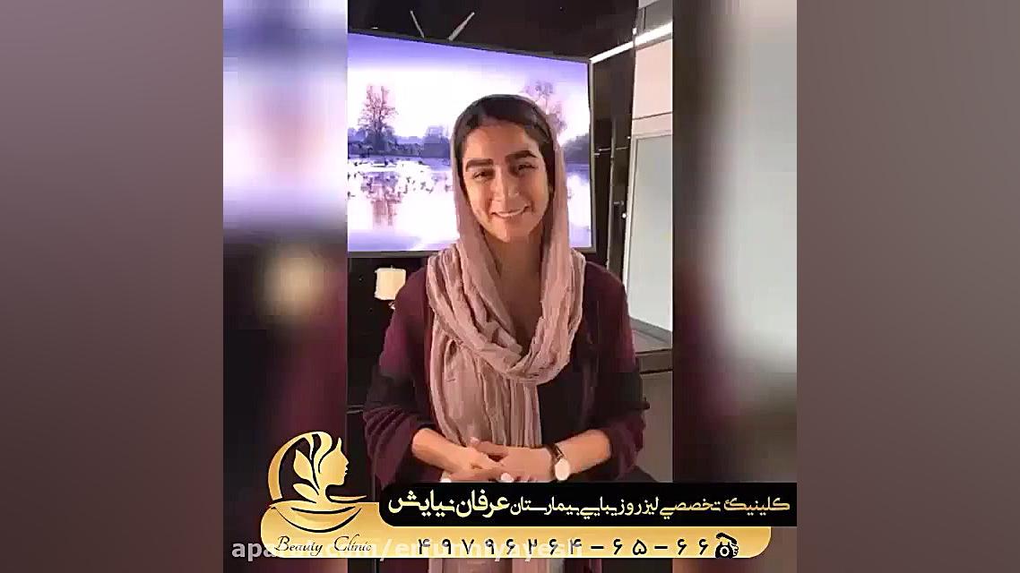 تجربه کاشت ابرو لیزر مو