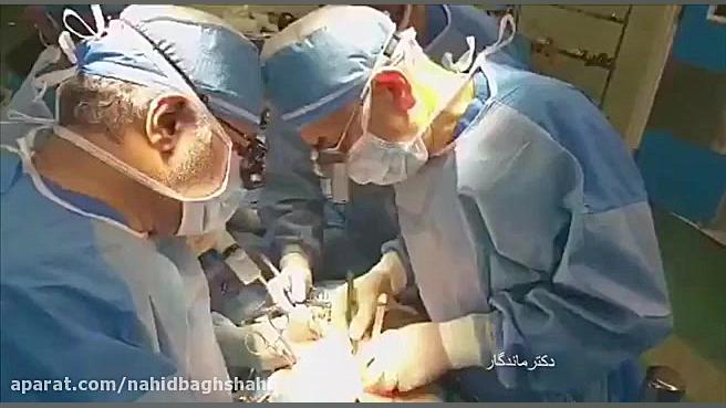 دکترماندگار ، انوریسم ائورت کامپوزیت ونیر