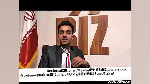 گانودرما پسوریازیس بیماری پسوریازیس چیست ؟پسوریازیس درمان دارد ؟علائم پسوریازیس سحر قریشی