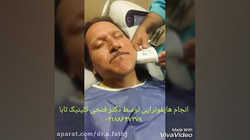لیفت صورت با هایفوتراپی جراحی فک
