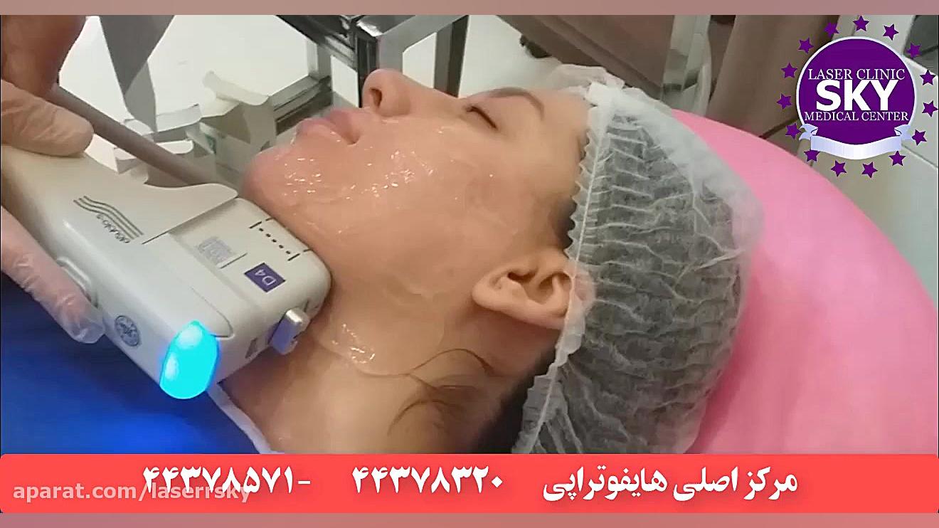 مرکز هایفوتراپی کامپوزیت ونیر