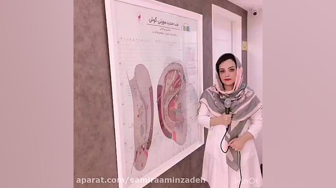 موارد کاربرد ایمپلنت ASP گوش در مشهد ترانه علیدوستی