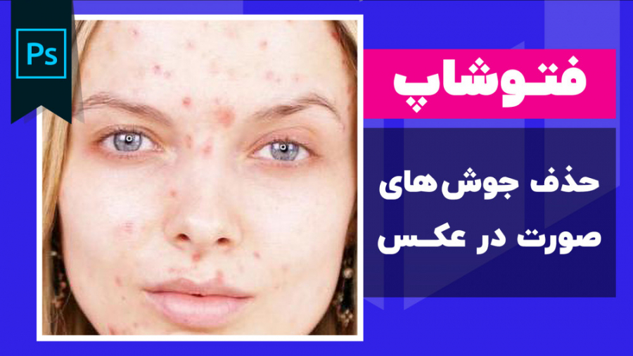 آموزش حذف جوش صورت در فتوشاپ