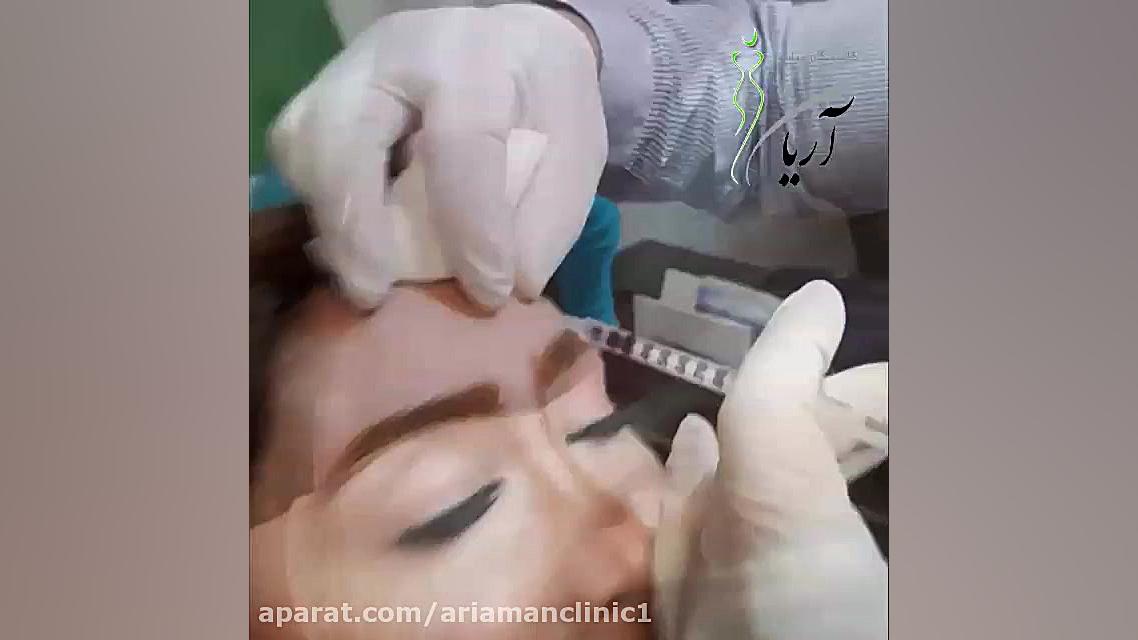 فیلم مراحل تزریق ژل و بوتاکس | تزریق ژل لب | کلینیک آریامن پوسیدگی دندان