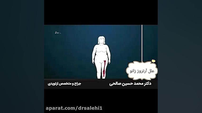 علت آرتروز زانو چیست؟ اینسایزینگ