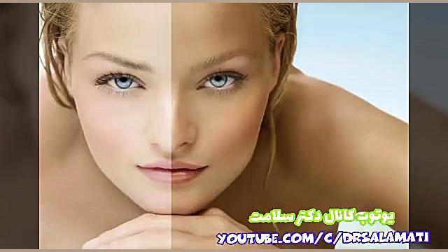 از بین بردن تیرگی پوست با روشهای طبیعی خانگی کلینیک زیبایی