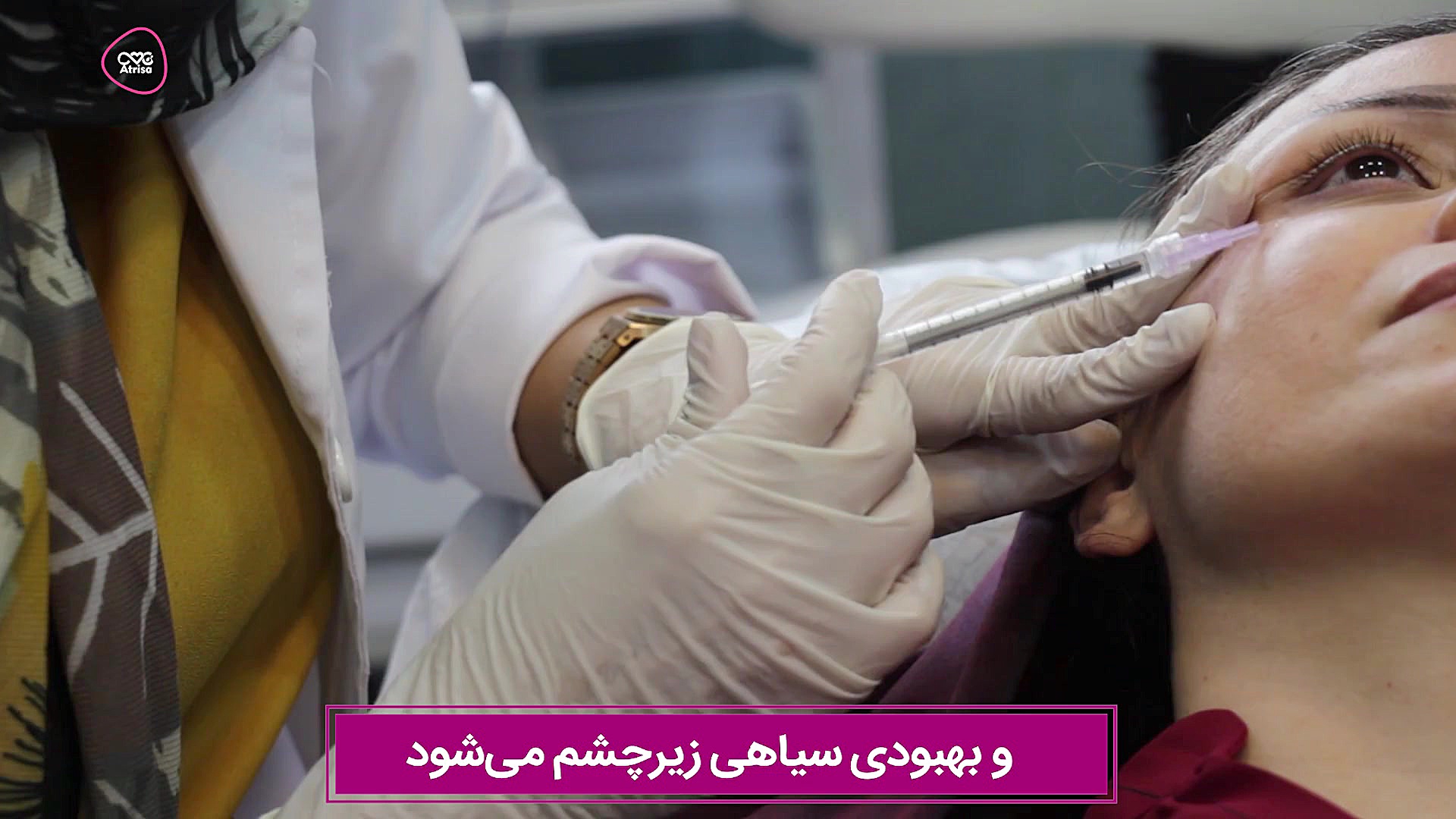 مزوتراپی زیر چشم مایکروگناتیا