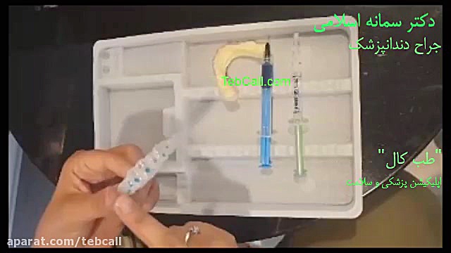 روش صحیح سفید کردن دندان در خانه (بلیچینگ در خانه ) Cytotoxicity Assay