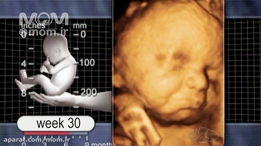 هفته سی ام بارداری