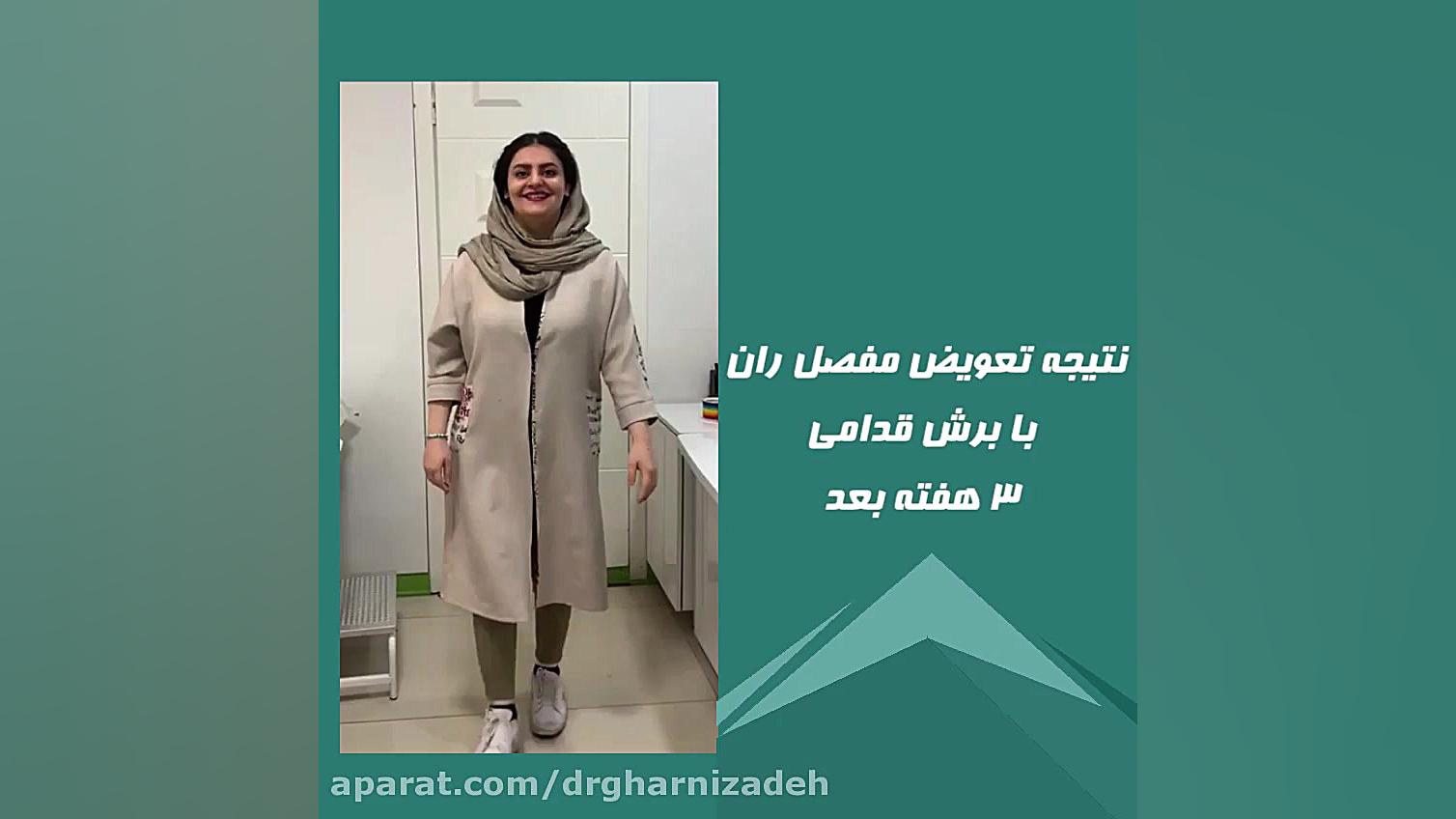 نتیجه جراحی تعویض مفصل ران به روش قدامی توسط دکتر کاوه قرنی زاده متخصص ارتوپدی لیفت پیشانی