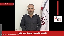 فیلم کاشت مو | کلینیک پوست و مو هلیا | شماره 29 | 02179547