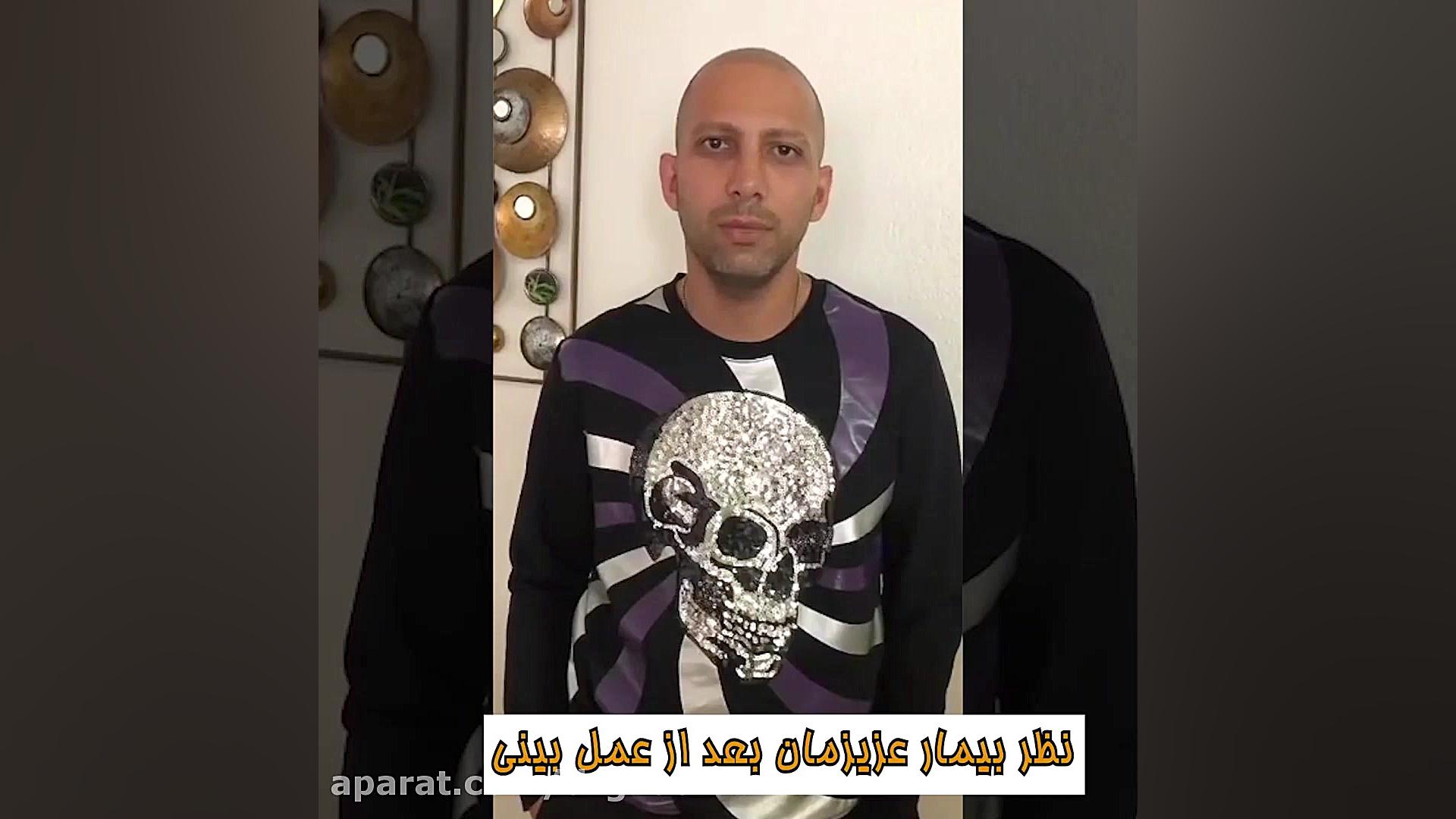 بعد از عمل بینی دکتر مهدی قدیری