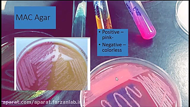 تست های بیوشیمیایی رایج و محیط های کشت باکتری تام کروز