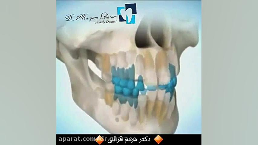 مراحل رشد دندان دکتر مریم قرایی