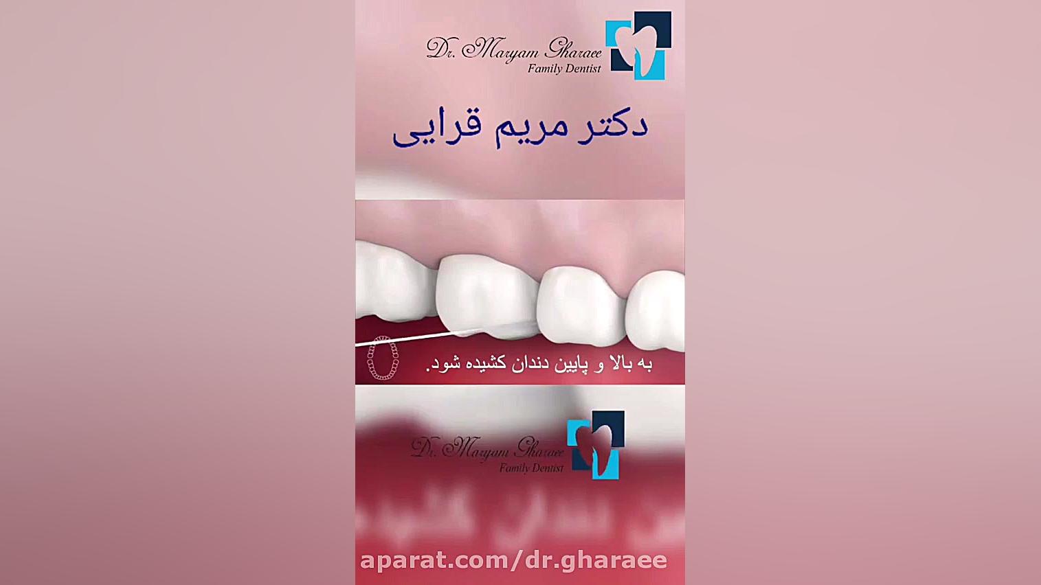 روش استفاده از نخ دندان دکتر مریم قرایی
