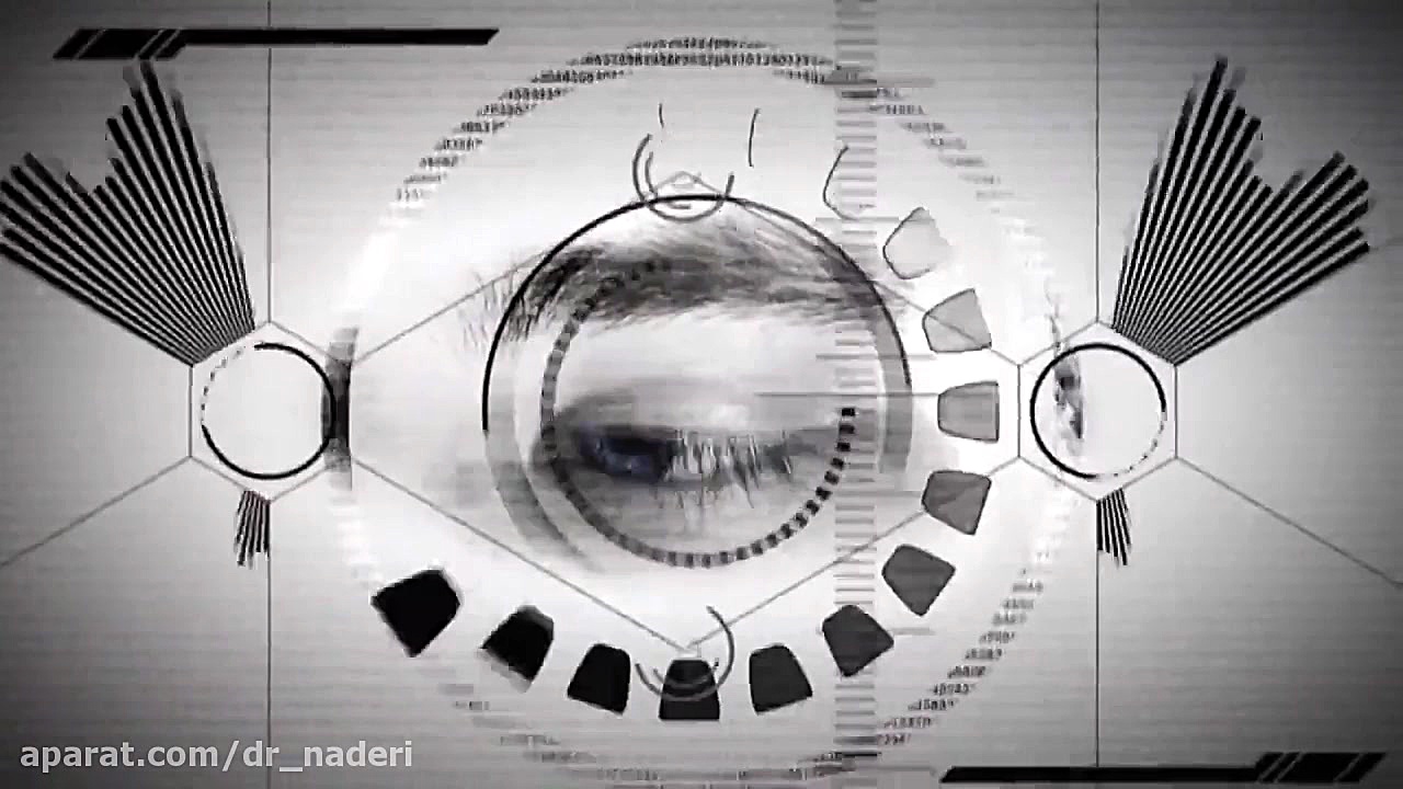 عدسی چشم - مرکزچشم پزشکی دکتر علیرضانادری مرکز چشم پزشکی دکتر علیرضا نادری www.dr-naderi.com