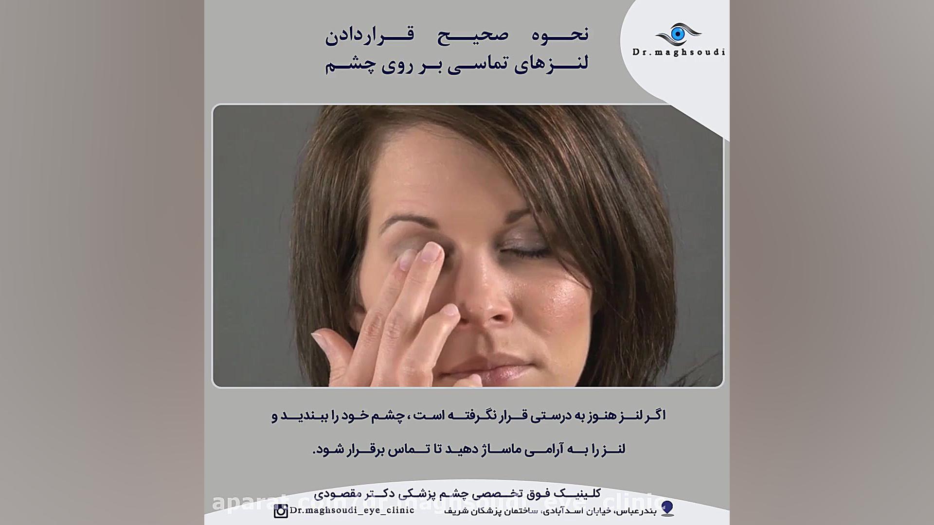 نحوه گذاشتن لنز تماسی بر روی چشم پروتز سینه