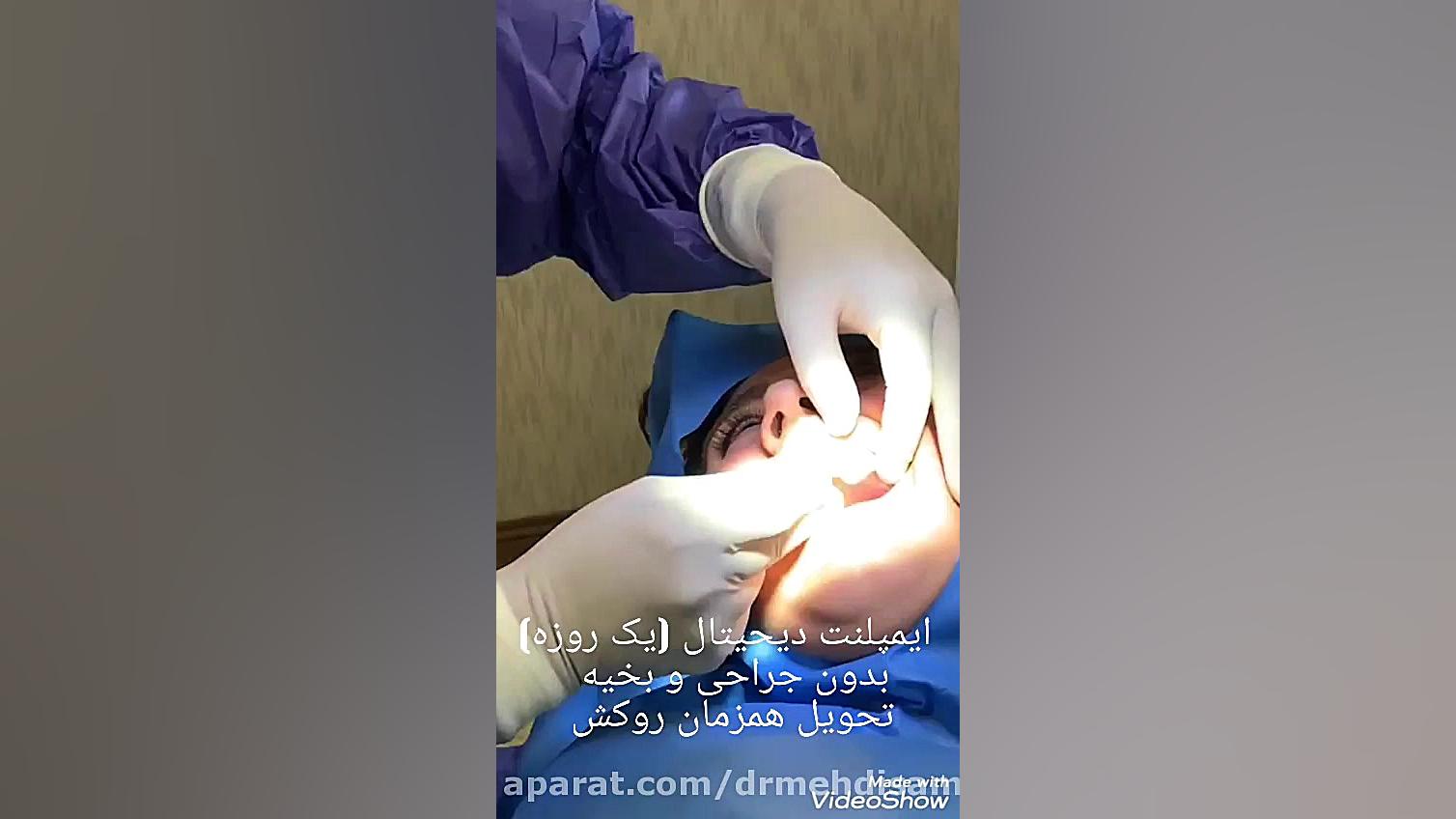 ایمپلنت دیجیتال کانال رسمی دکتر مهدی سمیعی