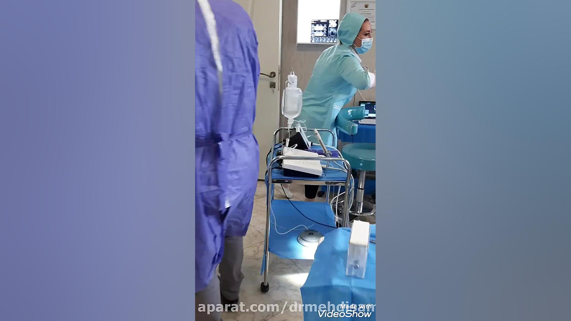 ایمپلنت یک روزه دندان کانال رسمی دکتر مهدی سمیعی