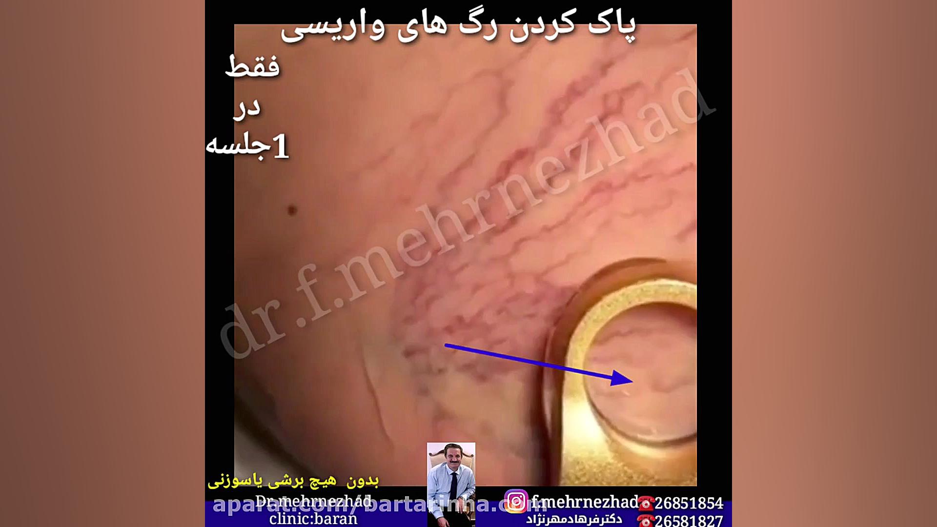 برترین ها - کلینیک پوست و مو دکتر مهرنژاد جراحی زیبایی پلک
