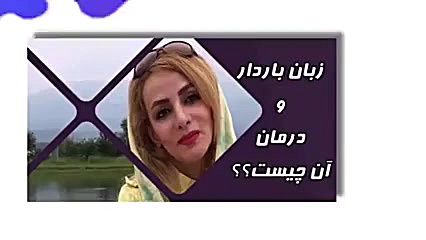 چرا زبان سفید می شود؟ دکتر ندا هادی-دندانپزشک زیبایی