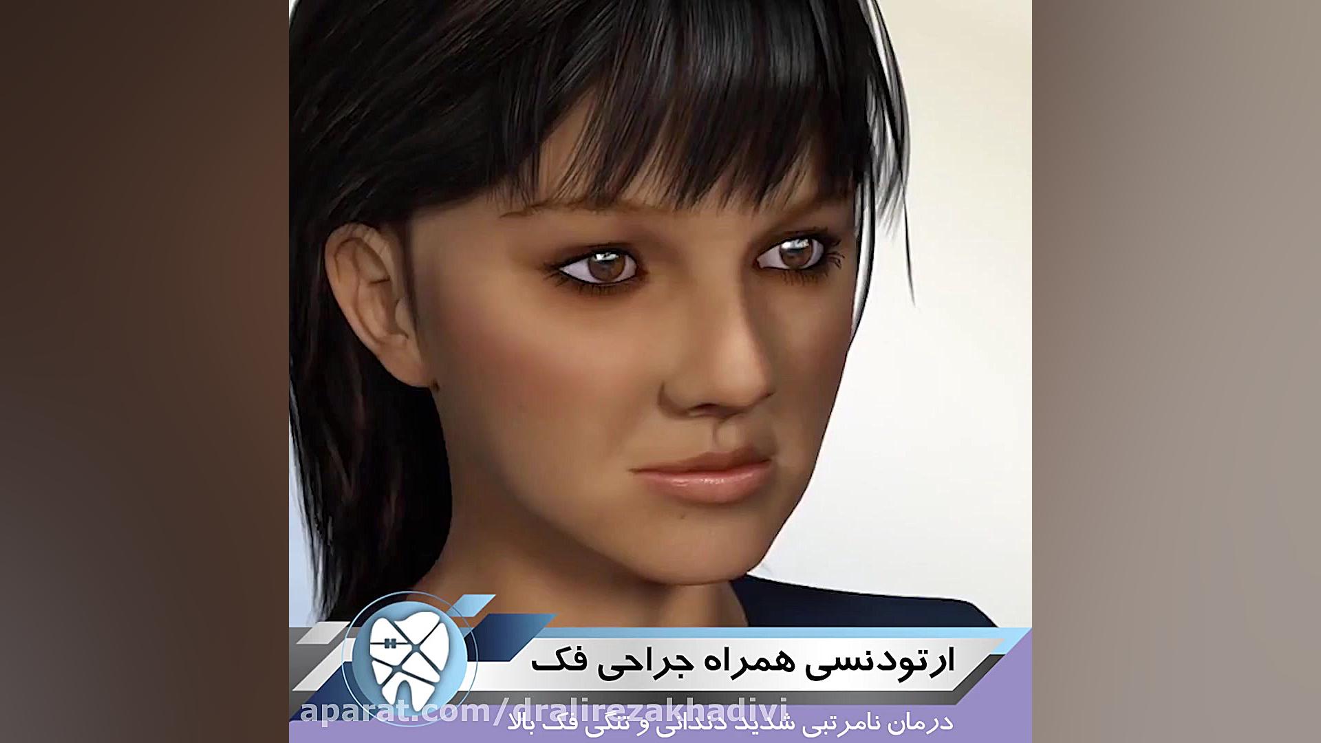 ارتودنسی همراه جراحی فک دکتر علیرضا خدیوی