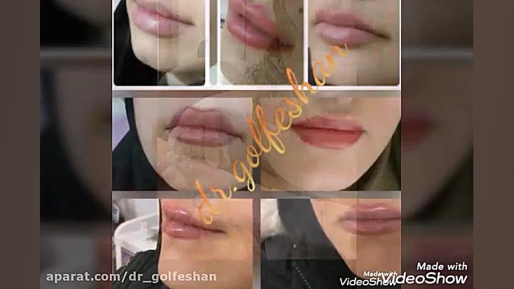 متخصص پوست و مو شرق تهران دکتر عاطفه گلفشان، متخصص پوست مو و لیزر درمانی