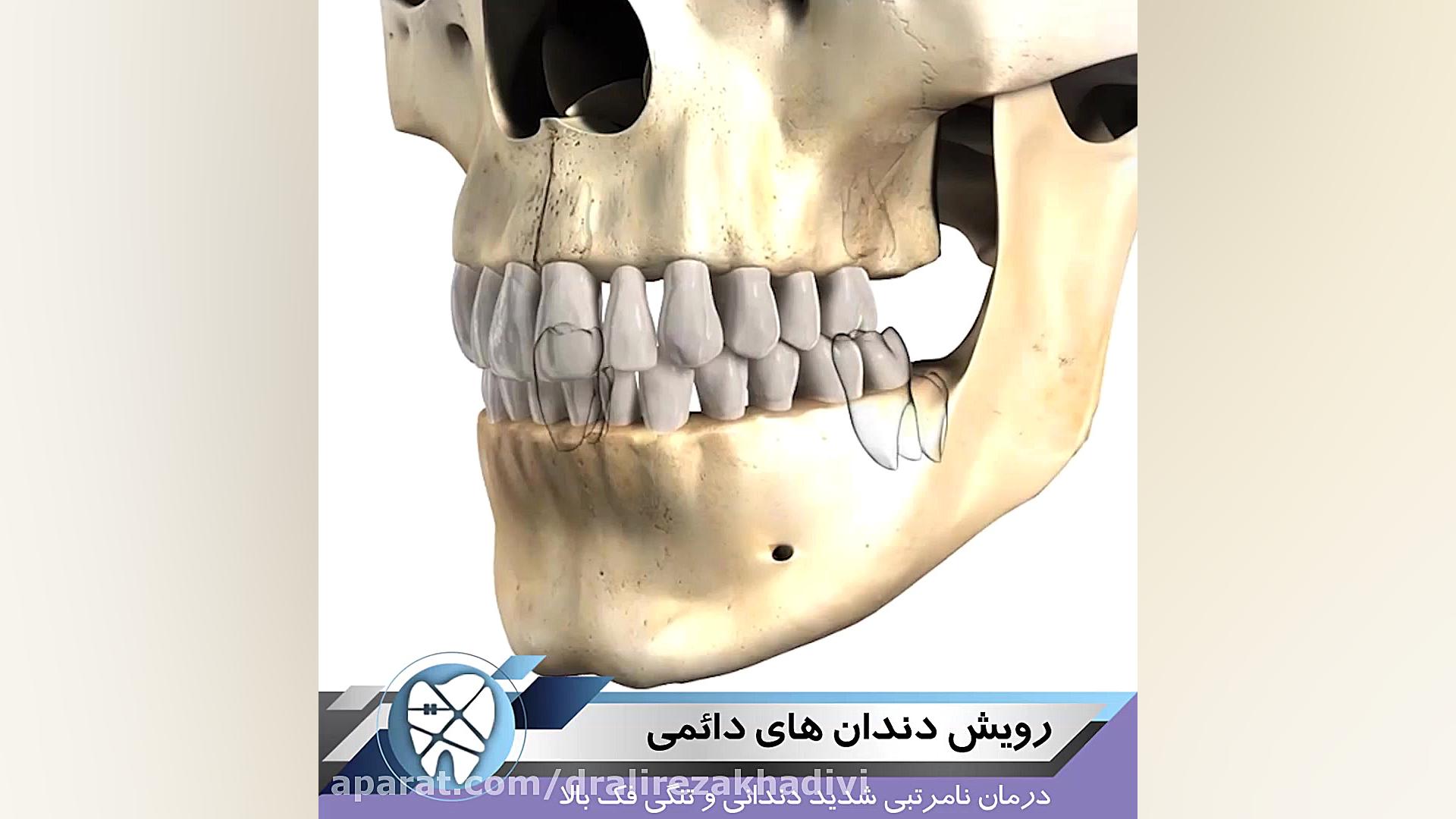 رویش دندان های دائمی دکتر علیرضا خدیوی