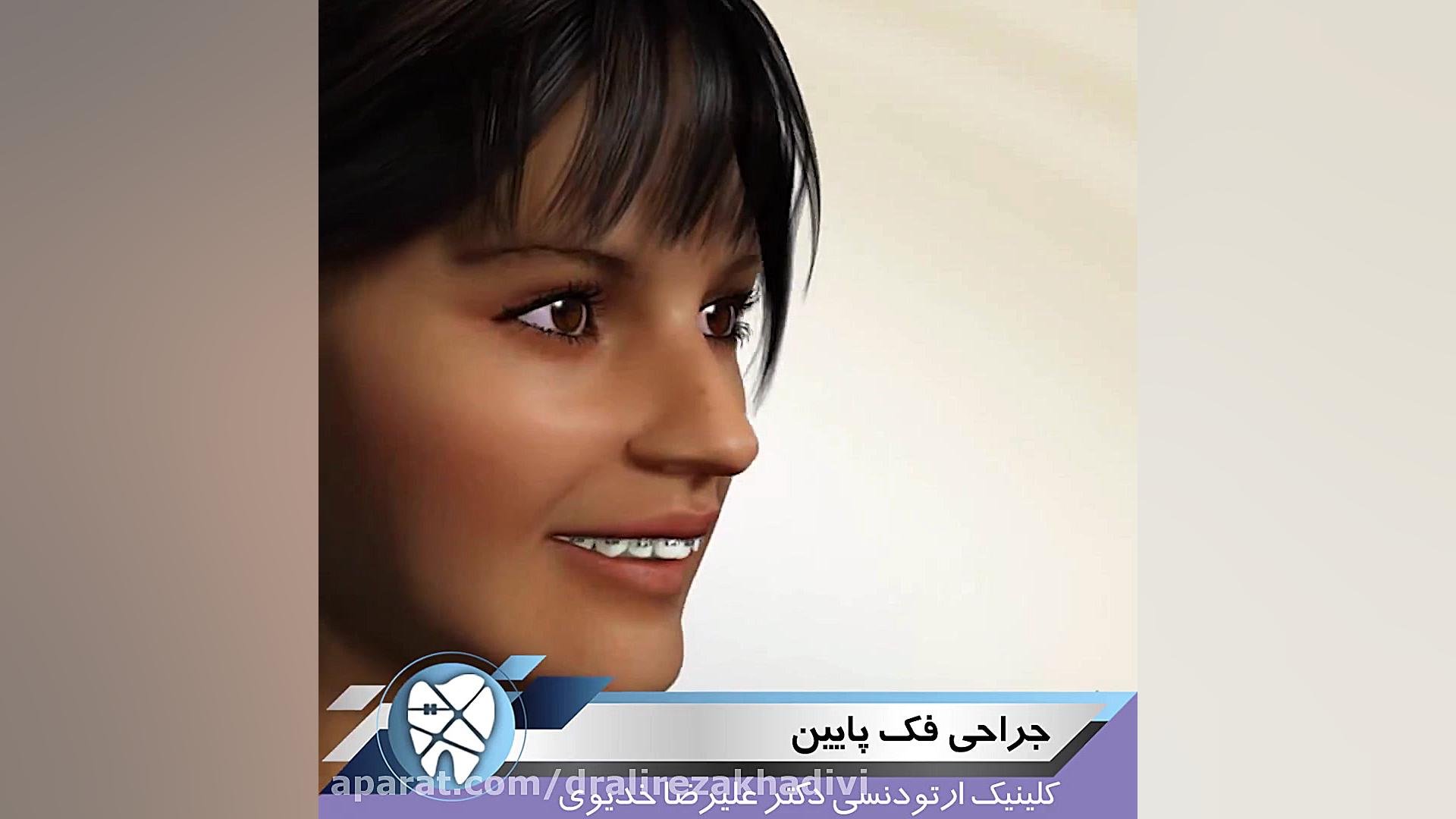 جراحی فک پایین دکتر علیرضا خدیوی