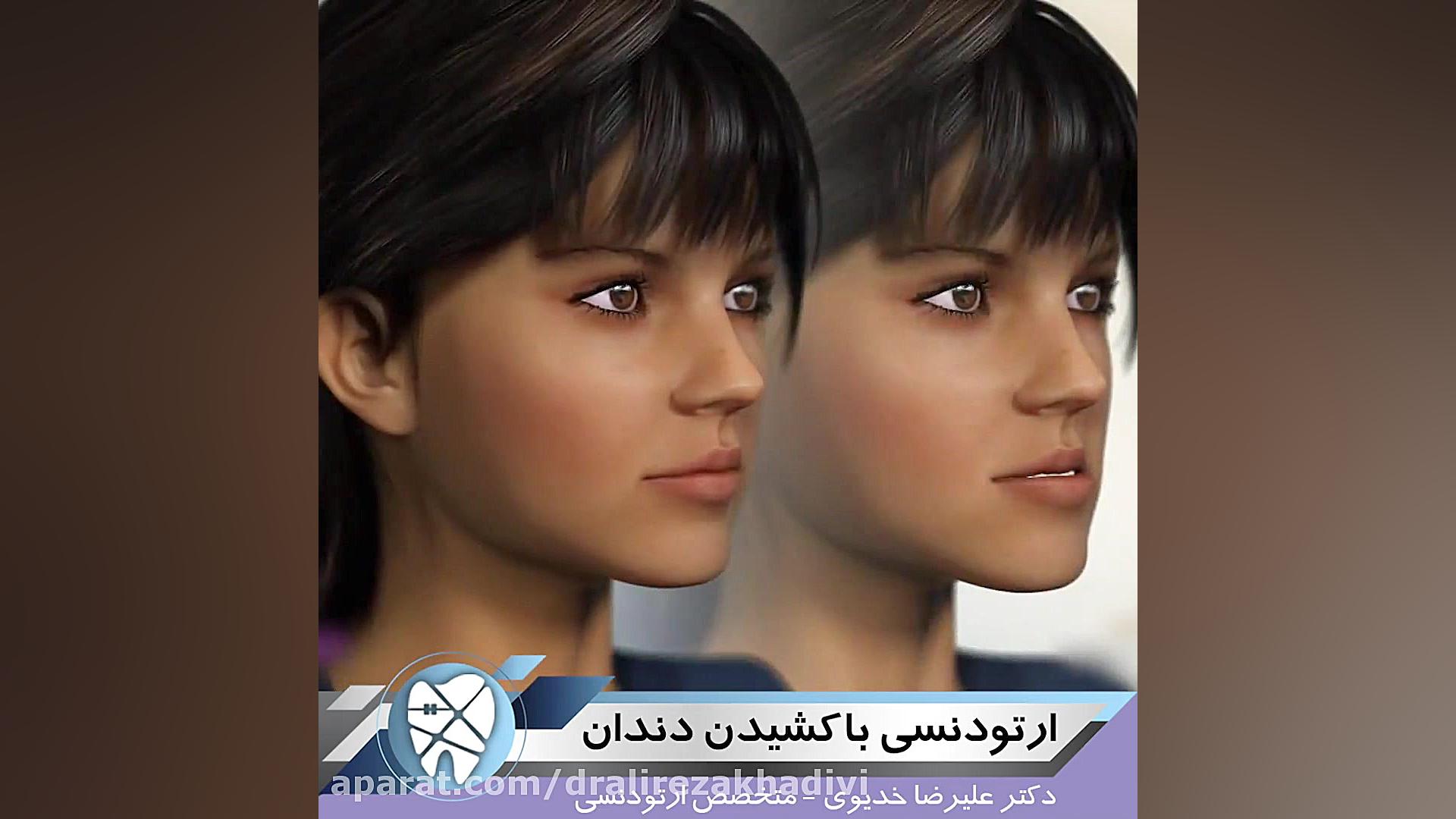 ارتودنسی با کشیدن دندان دکتر علیرضا خدیوی