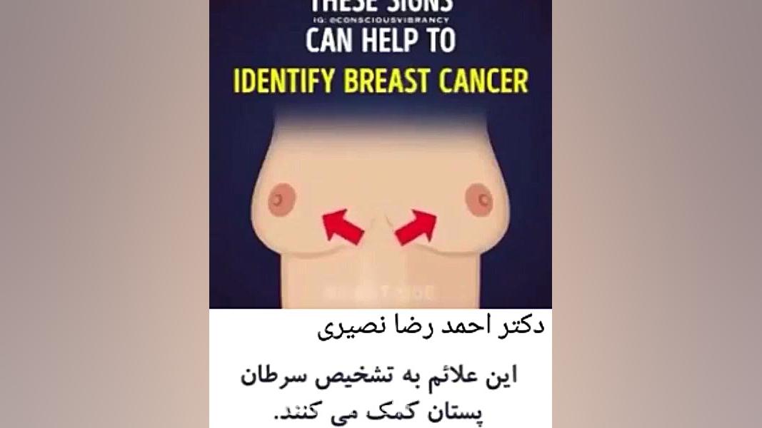 از کجا بفهمیم سرطان سینه داریم ؟ دکتر احمدرضا نصیری