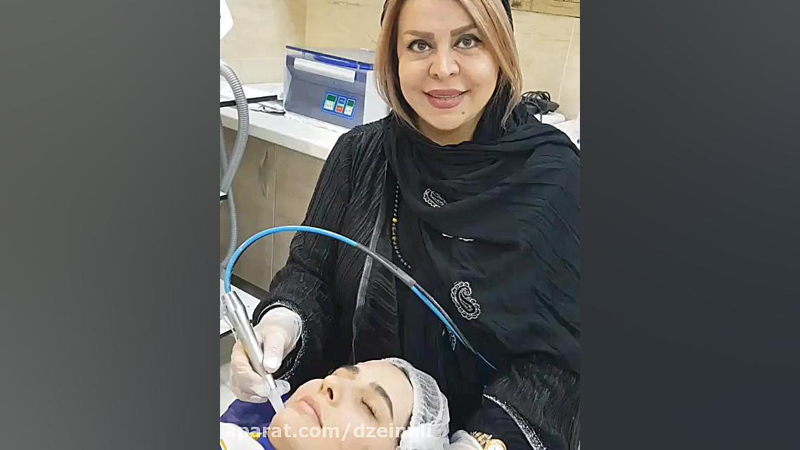 میکرودرم برای رفع کومدون (جوشهای سرسیاه) دکتر فرحناز زینعلی - متخصص پوست، مو، زیبایی زنجان