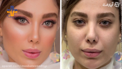 آرایش رزگلد، نیازهای قبل و بعد...