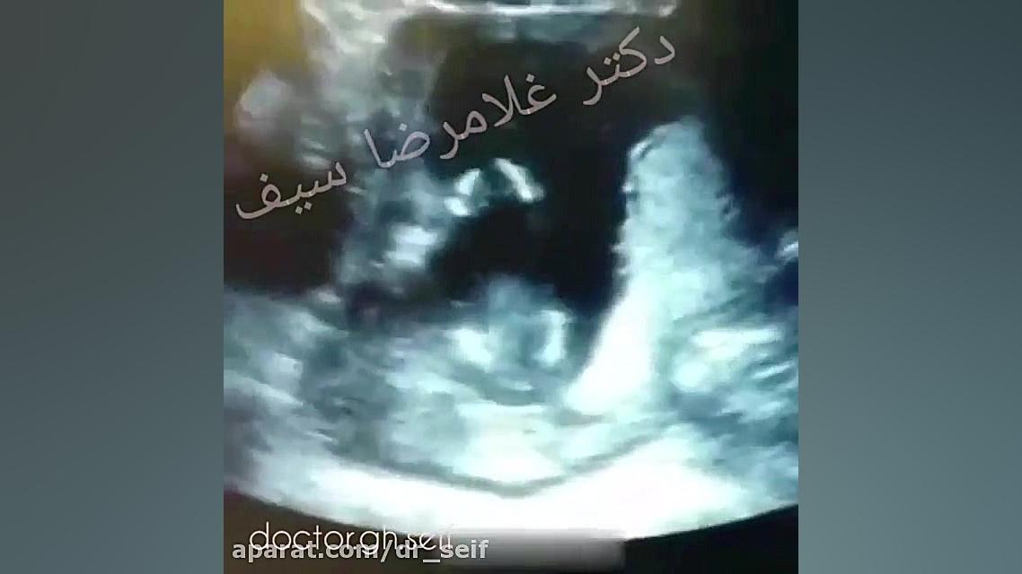 پدری و مادری که آواز می خوانند و جنین در شکم مادر دست می زند جاستین بیبر