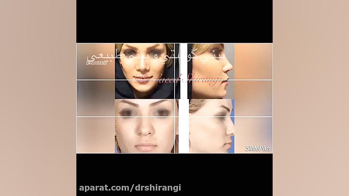 خدمات دکتر سعید شیرنگی فوق تخصص جراحی پلاستیک و زیبایی دکتر سعید شیرنگی (فوق تخصص جراحی پلاستیک و زیبایی)