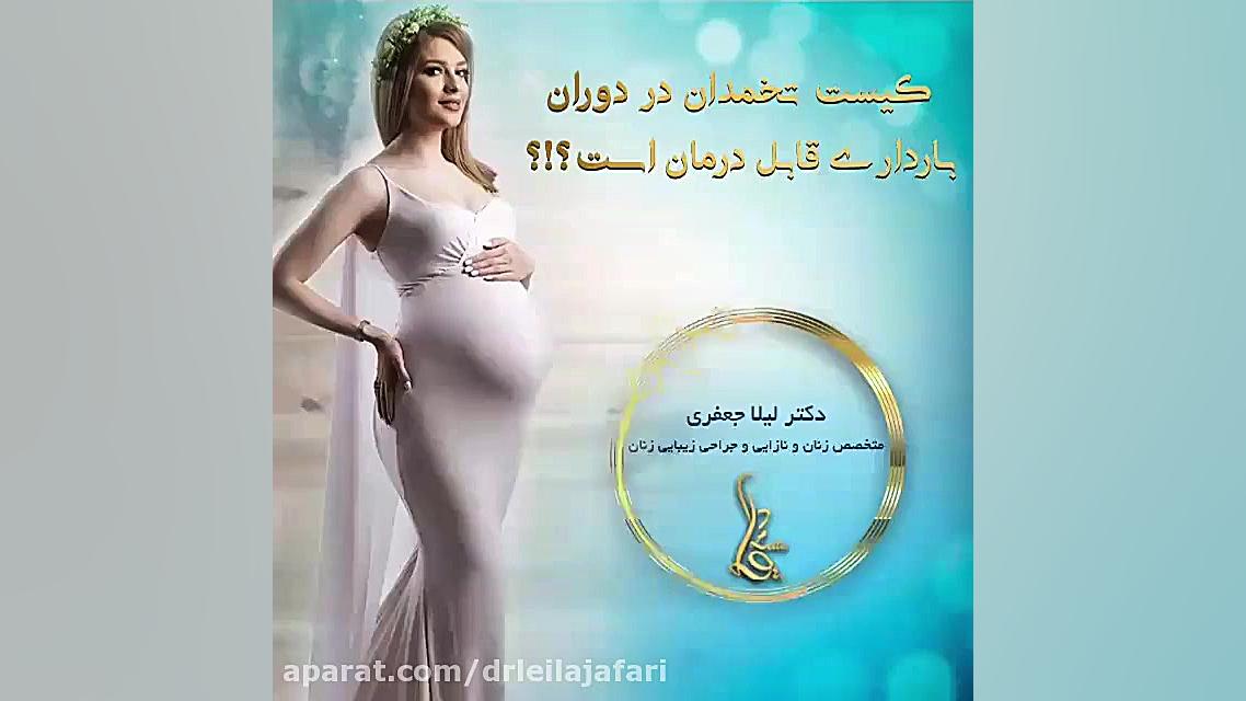 پاسخ به سوال کیست تخمدان دوران بارداری دکتر لیلا جعفری